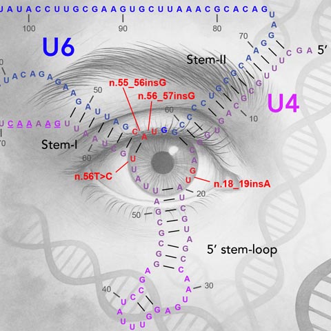 Forschende des Instituts für Molekulare und Klinische Ophthalmologie Basel (IOB) deckten Ursache für erblichen Sehverlust auf. IIllustration ©IOB
